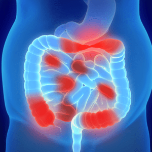 Mastering Inflammatory Bowel Disease