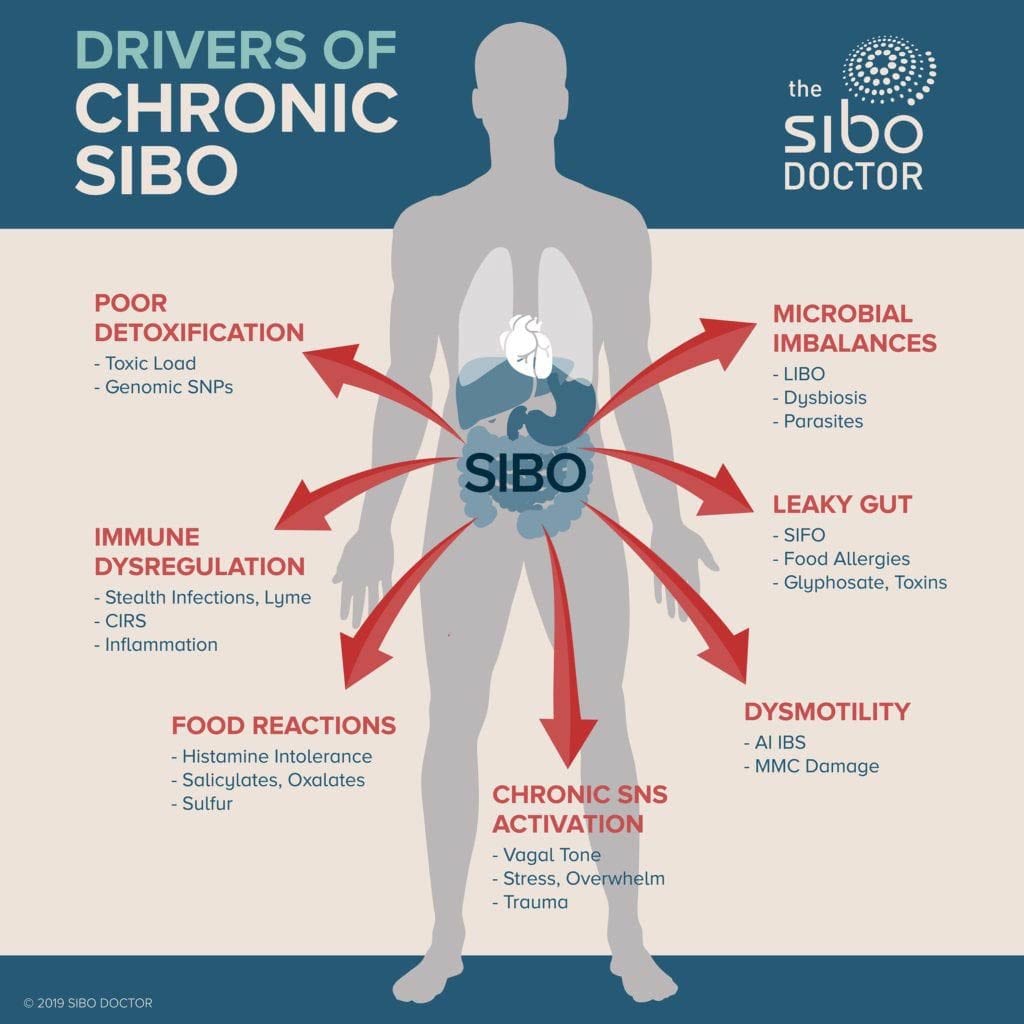 Drivers of Chronic SIBO by The SIBO Doctor